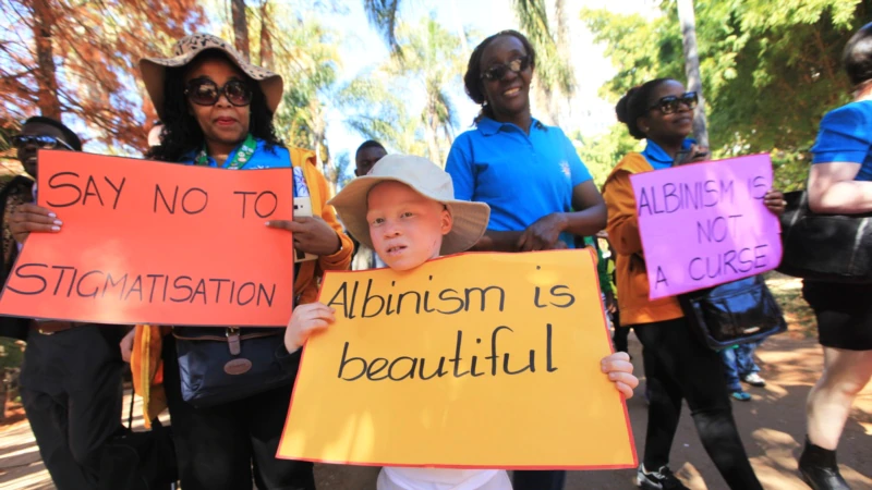 UN Concerned About Minority Group Discrimination in Benin, Zimbabwe